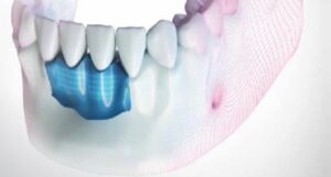 Jaw and teeth Xray